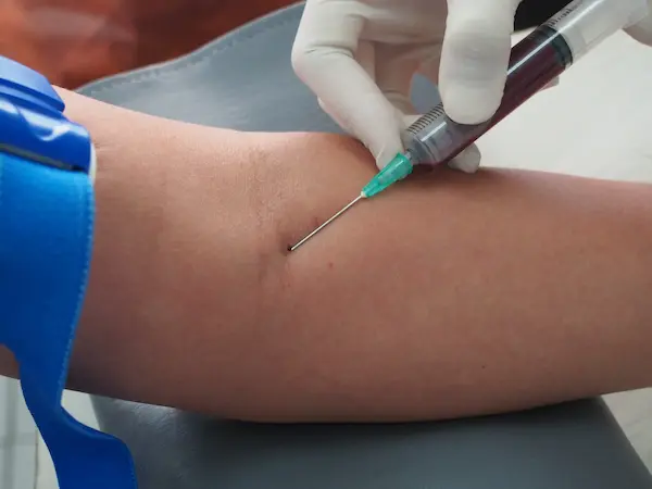 can you refuse blood test dui DUI Blood Test